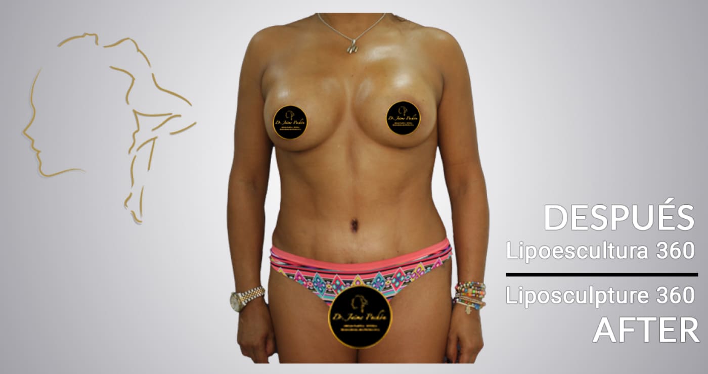 clinica estetica liposuccion